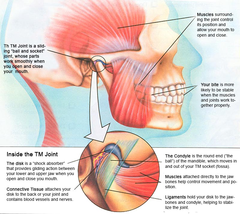 Disorder tmj TMJ Disorders: