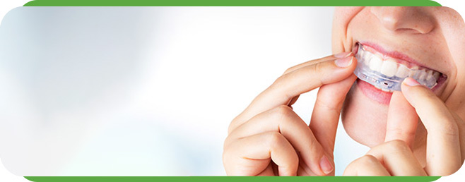 Sleep Apnea Oral Appliance Reviews Questions and Answers Sleep Apnea Oral Appliance Reviews Questions and Answers