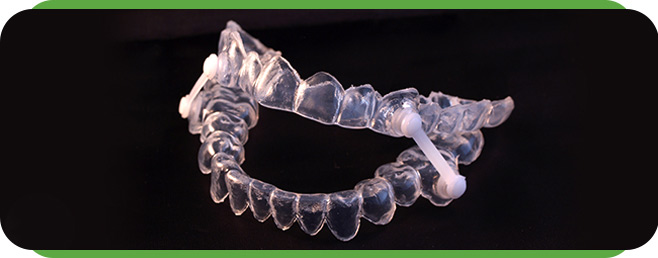 Oral Appliance Sleep Apnea Treatment Changed My Life
